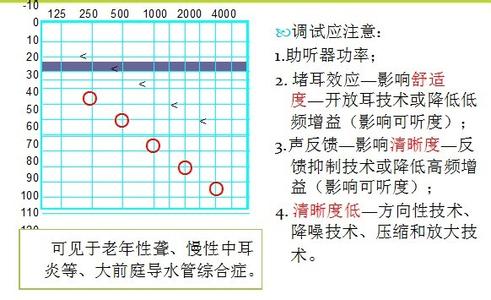 助听器的选择注意事项