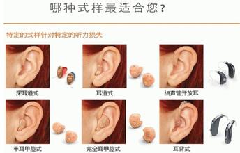助听器的分类