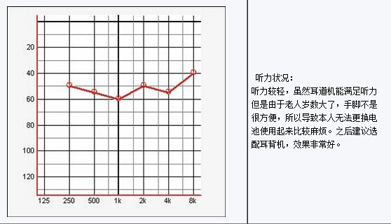 听力图