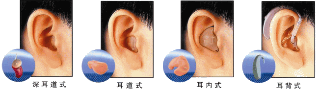 助听器佩戴效果图,助听器堵耳效应